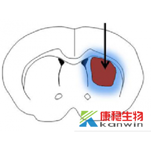 脑出血模型