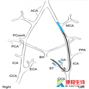 缺血性脑卒中模型